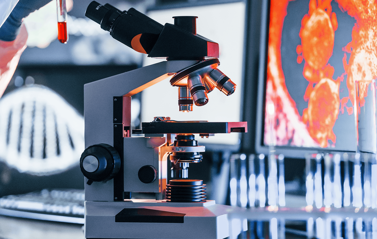 XENON CSL Case Study